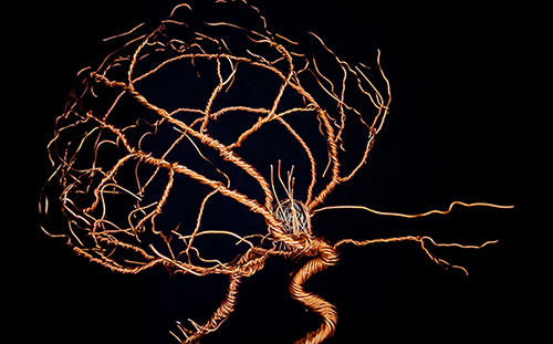 A wire sculpture of the brain's vasculature