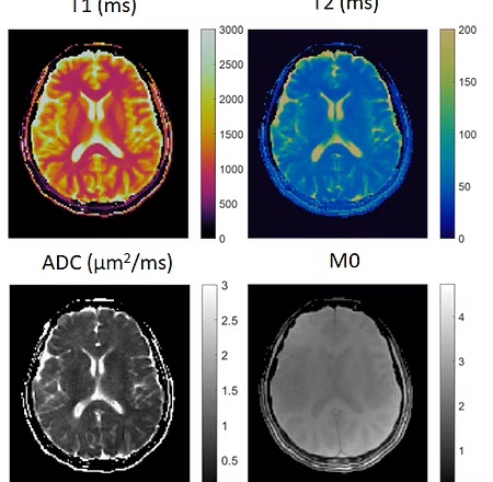 Brain imaging