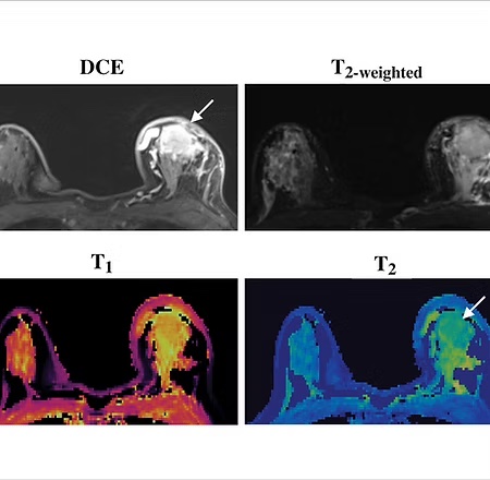 Brain imaging