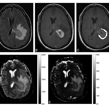 brain imaging