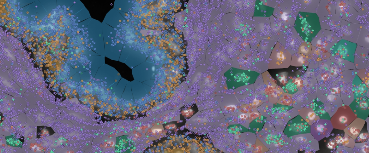Image depicting brain tumor omic program
