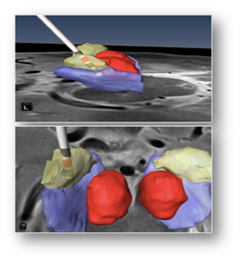 DTS Computing AI Health Electrodes