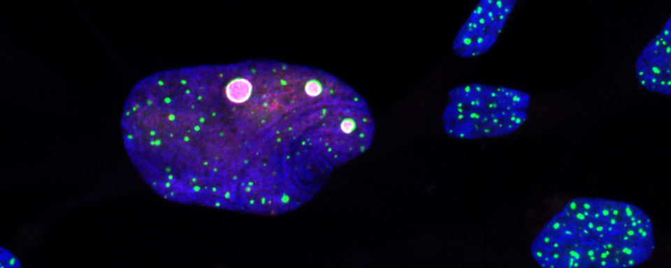 An image of telomeres